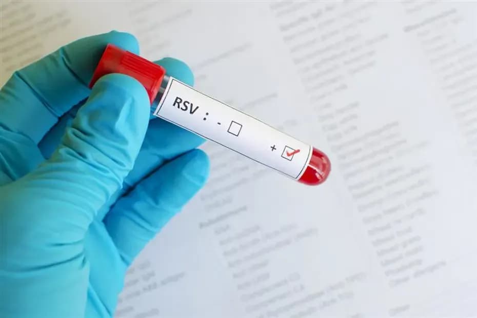 RSV Virüsü: Çocukları Hedef Alan Tehlike ve Damlacık Yoluyla Bulaşma Riski